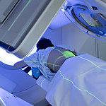 Woman Receiving Radiation Therapy/ Radiotherapy Treatments for Thoracic Cancer